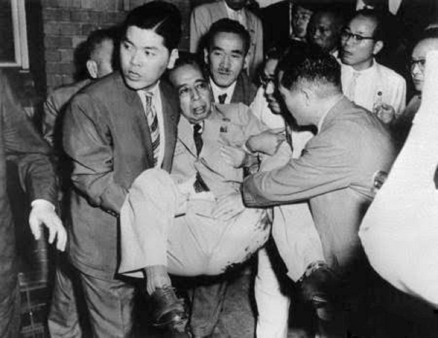 安倍晋三的外公岸信介遇刺老照片.