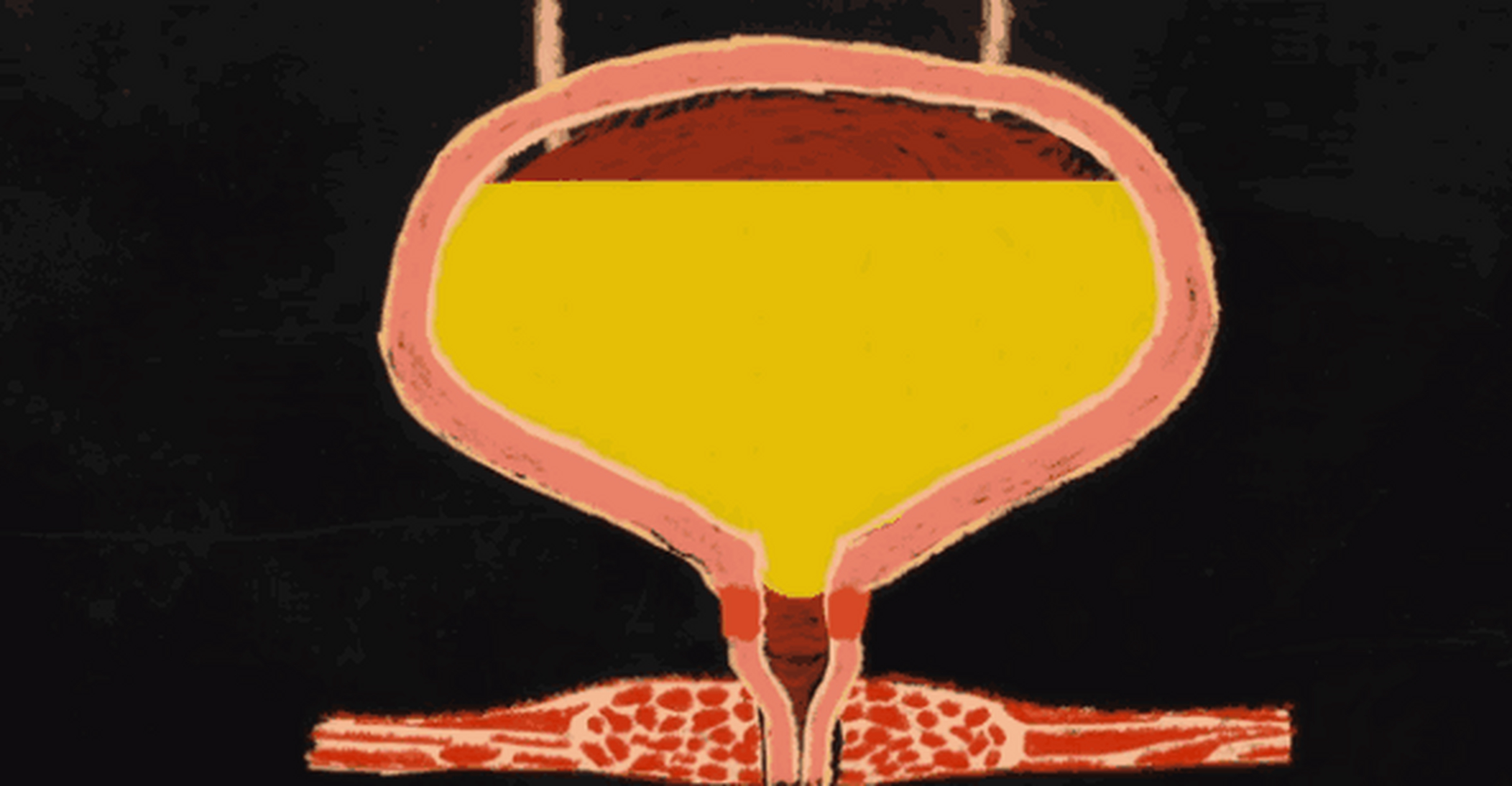 长期憋尿,你的膀胱可能真的会"炸"![doge][doge] 67676767