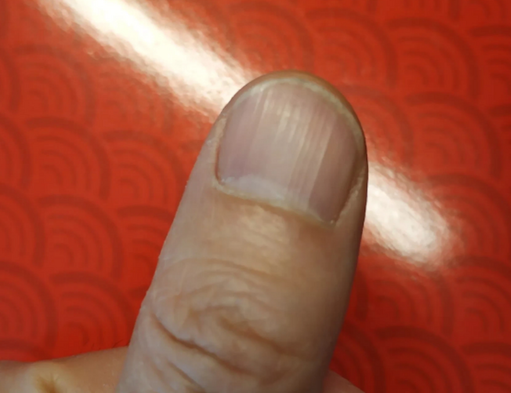 体格好的人,都有十大过人之处,自测一下: 长寿人群的特点▽ 1,指甲没