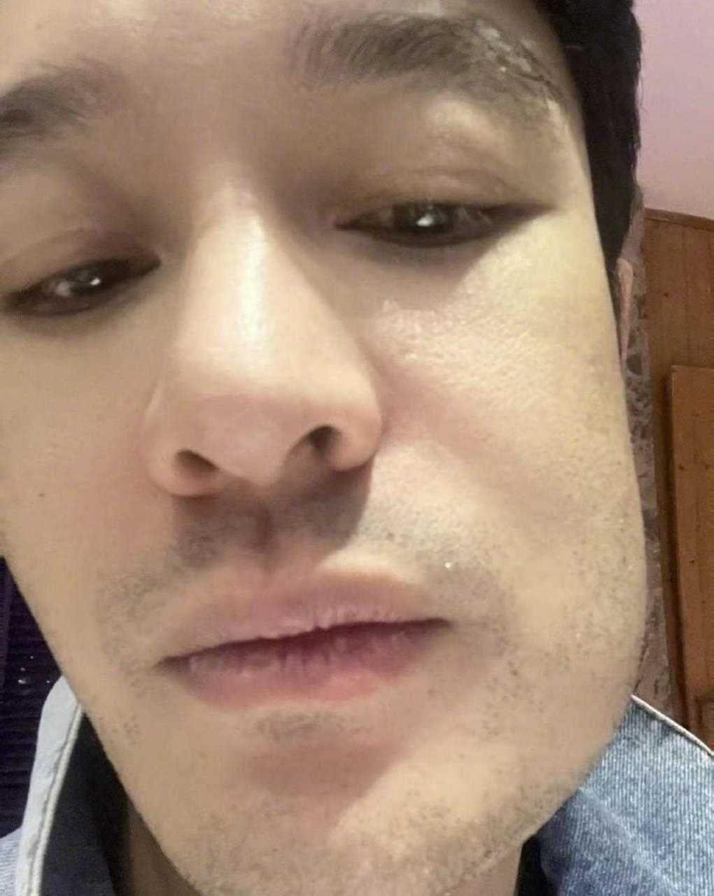 明星们拔完智齿的样子一个比一个生动.