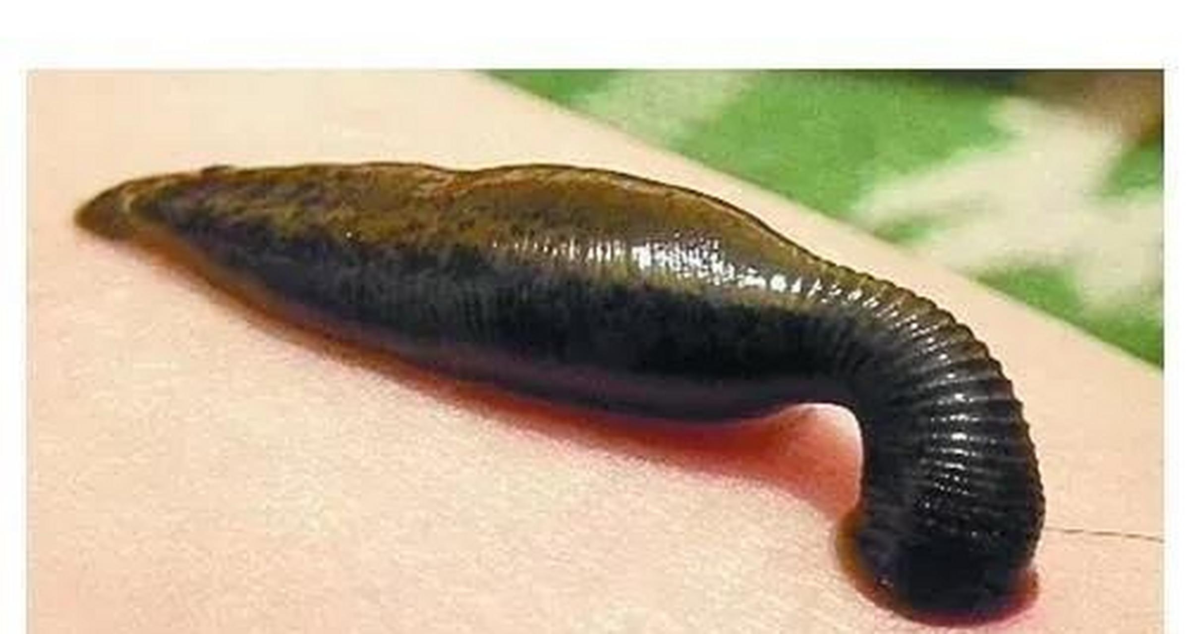 男子刚要转身离去,谁知其中一只水蛭,身长竟一下扩大十倍,而且张开