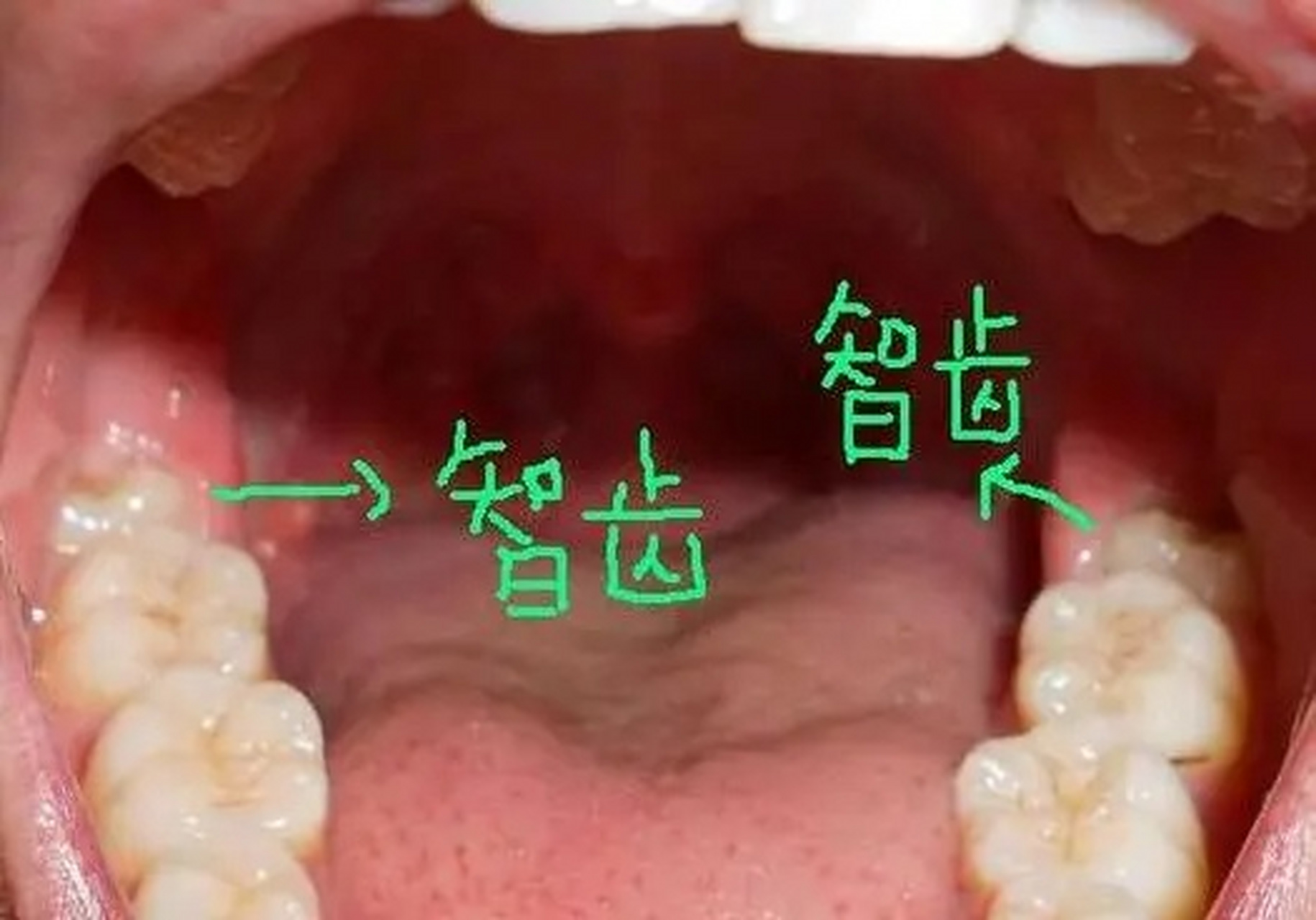 尽头牙图片位置图片