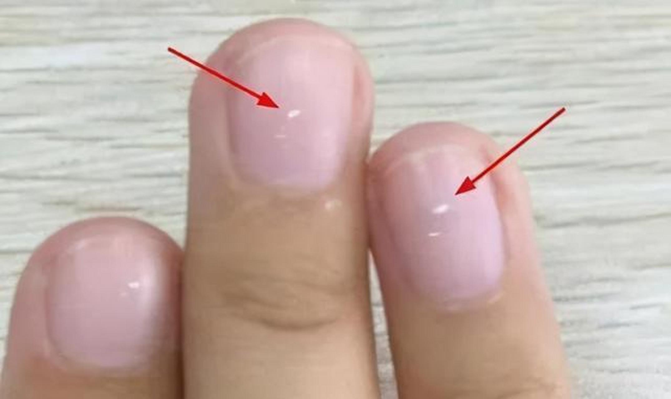 【指甲上月牙越多越健康?