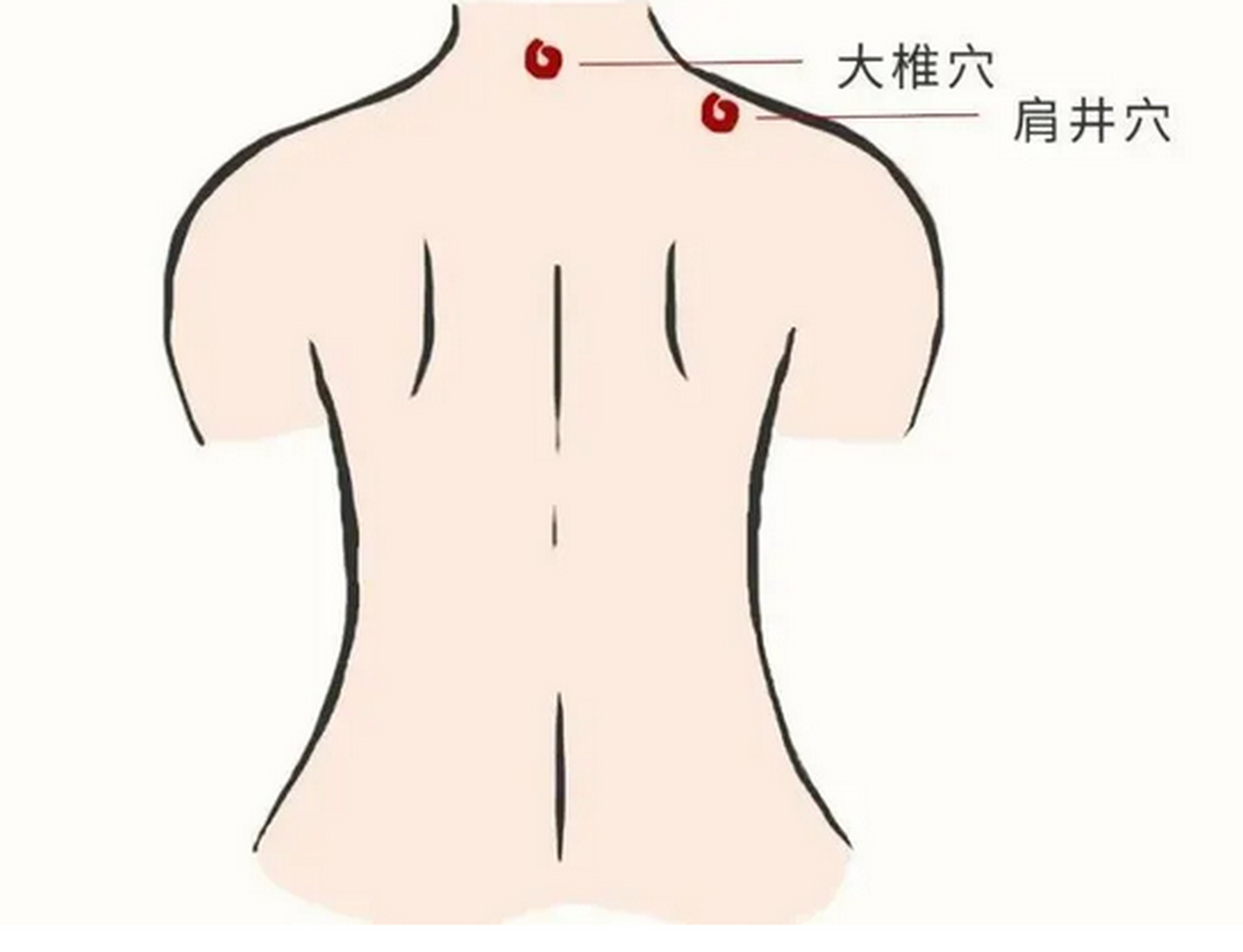 乳腺增生拔罐位置图图片