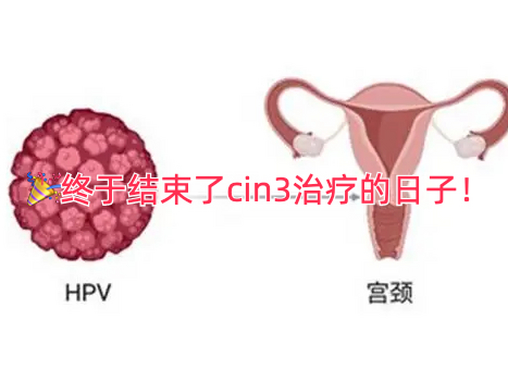 宫颈cin3的图片图片