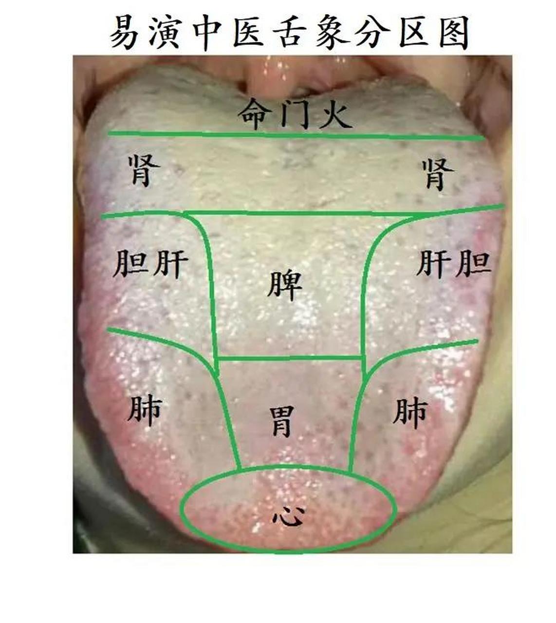 中医看舌头知病情图片图片