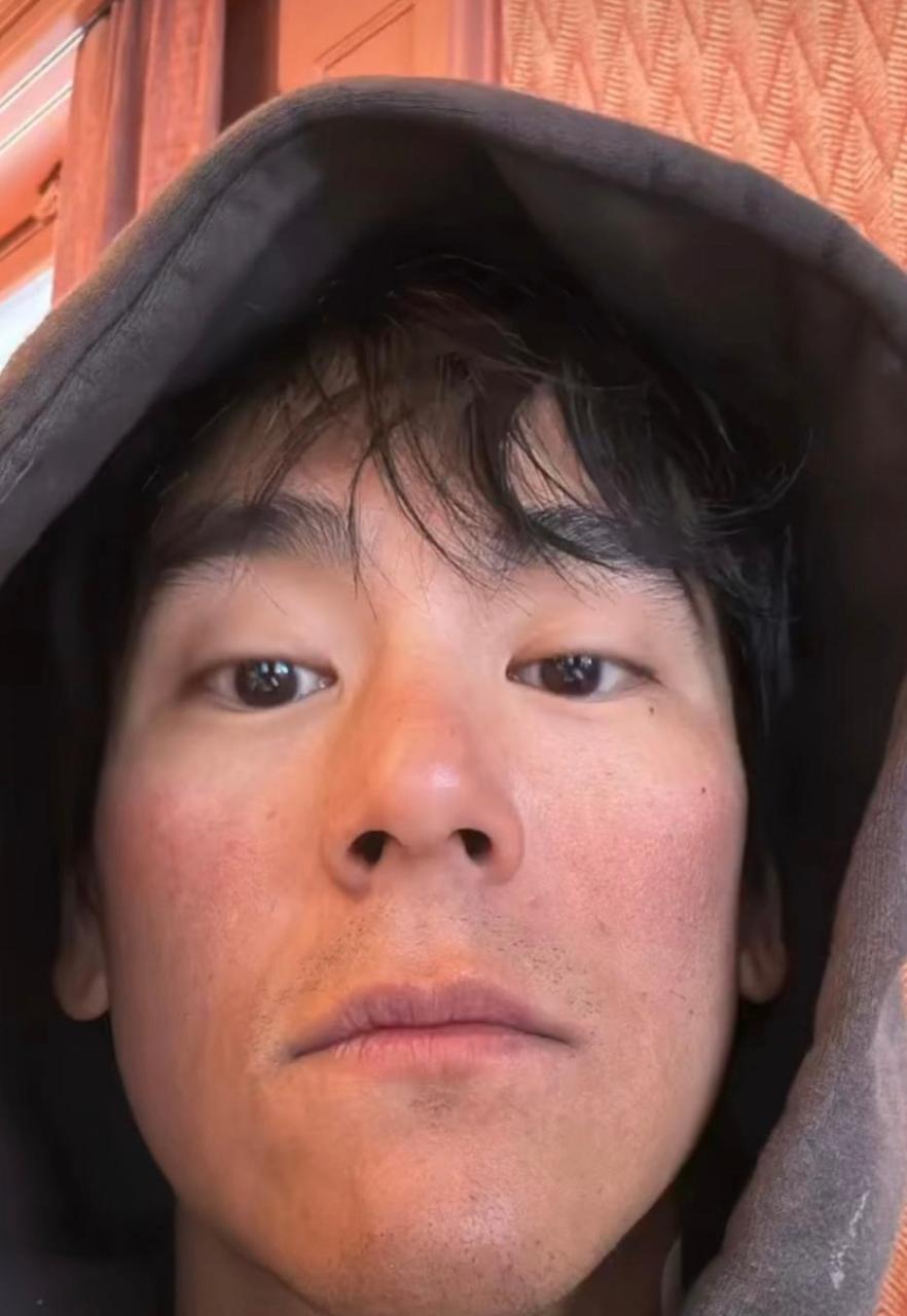 网友:彭于晏发脸部晒伤图毫无偶像包袱 #搞笑趣味图