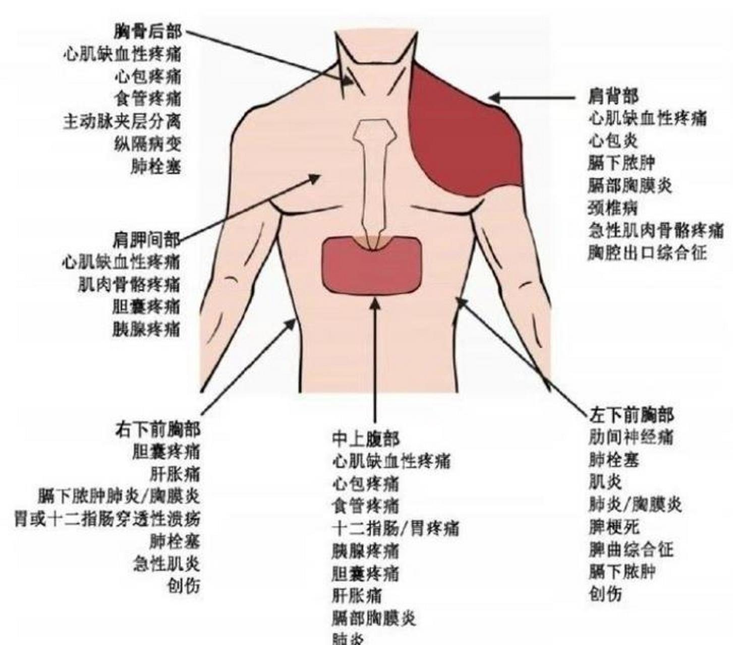 胸骨后疼痛位置示意图图片