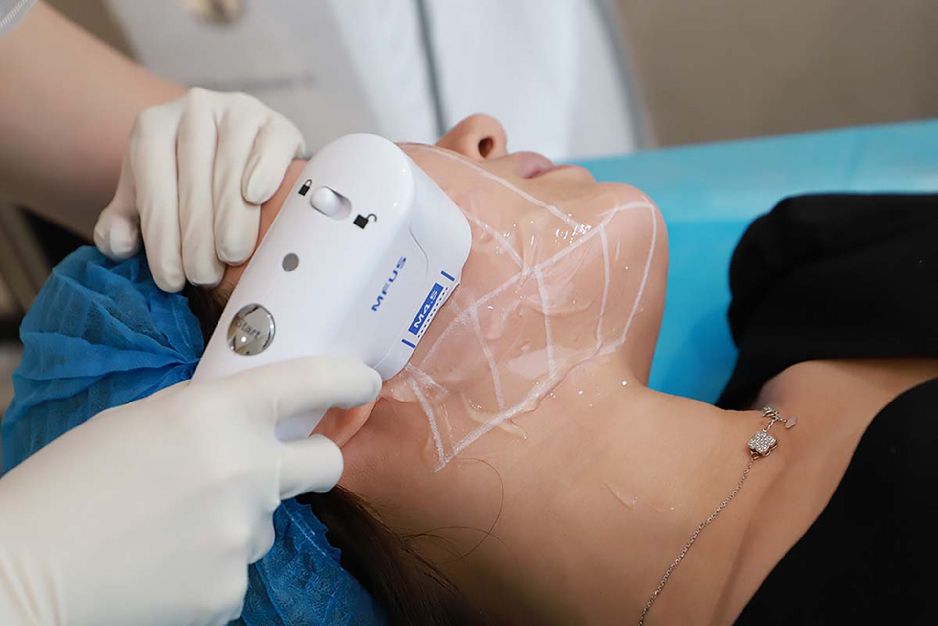 超声炮是不是不同的医生操作效果不一样? 是的.医生的经验和技术一定