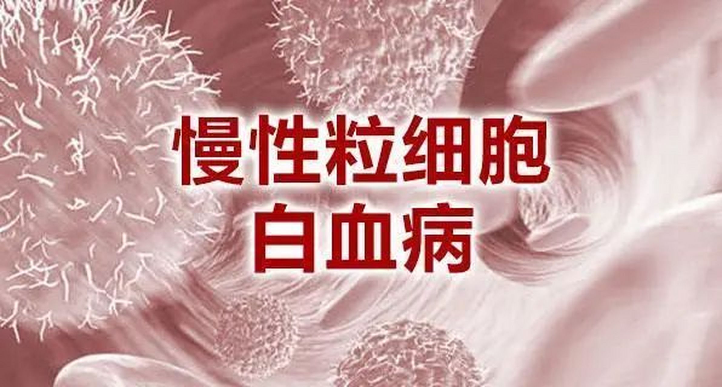 慢性粒细胞白血病是什么?