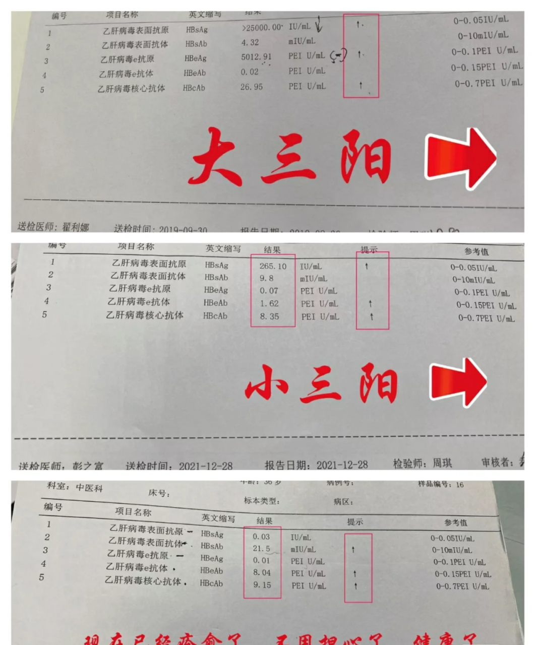 乙肝五项怎么算正常图片