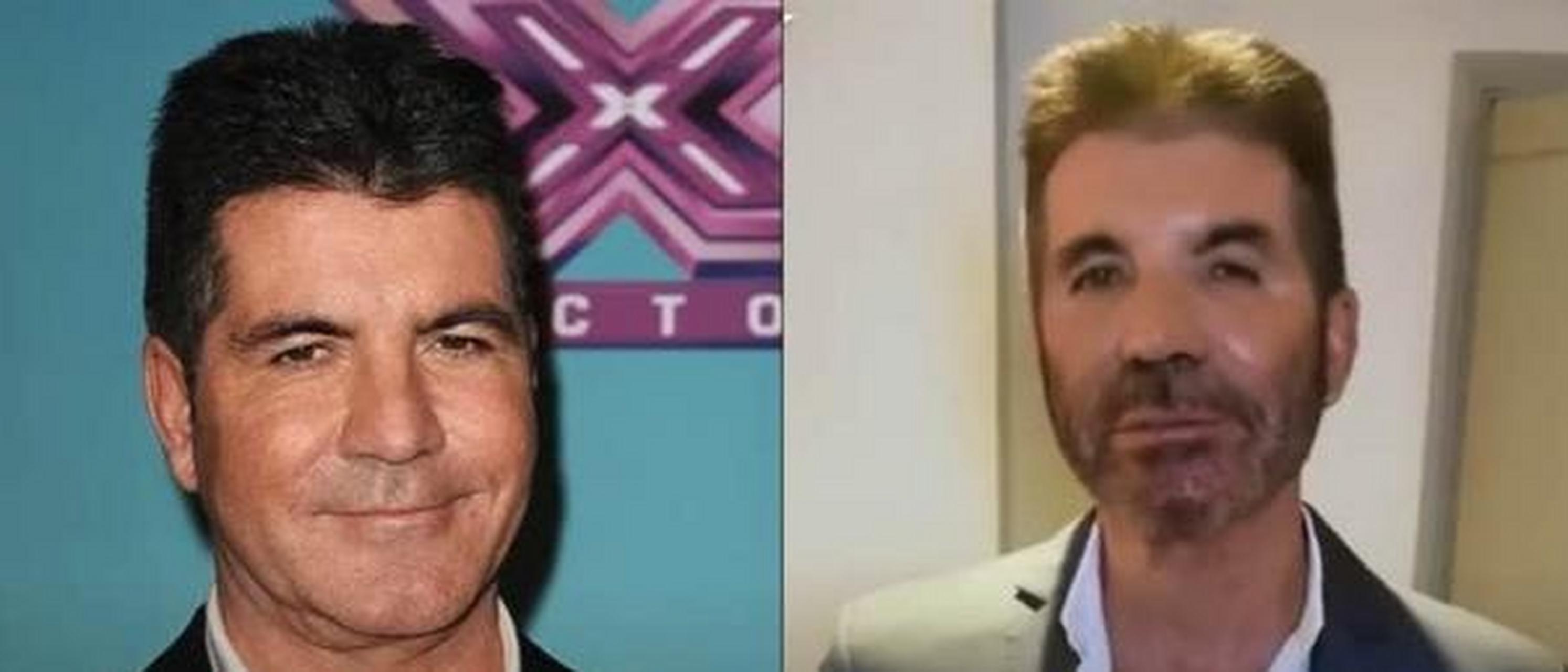 為什麼好萊塢音樂人simon cowell(西蒙·考威爾)的臉部慘遭毀容?