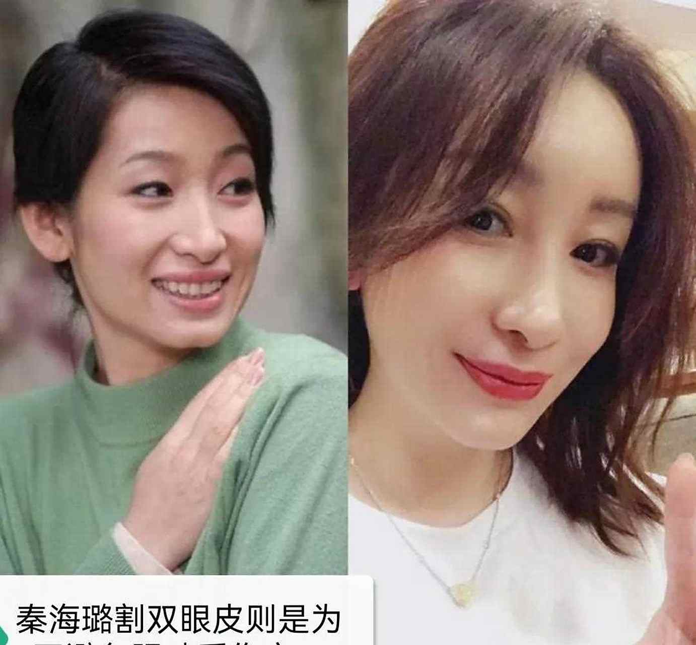 娱乐圈里戚薇怒认割双眼皮,"割过双眼皮"的明星,你若一-位不认识,算我