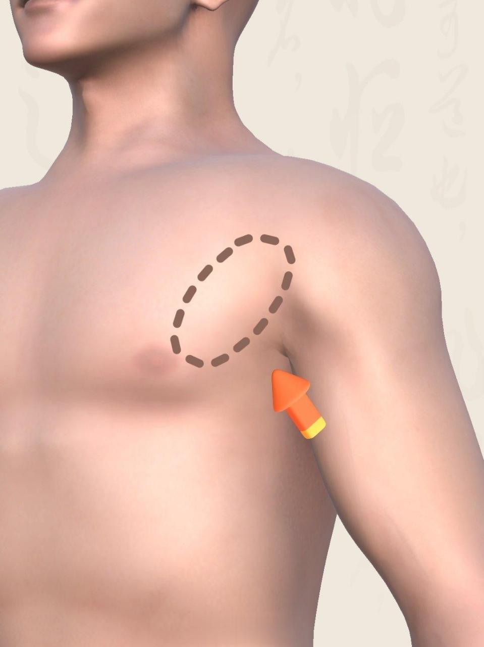 【肩胛骨缝疼】肩胛骨缝疼,一般情况下是肩胛骨不稳定了,前后肌肉张力