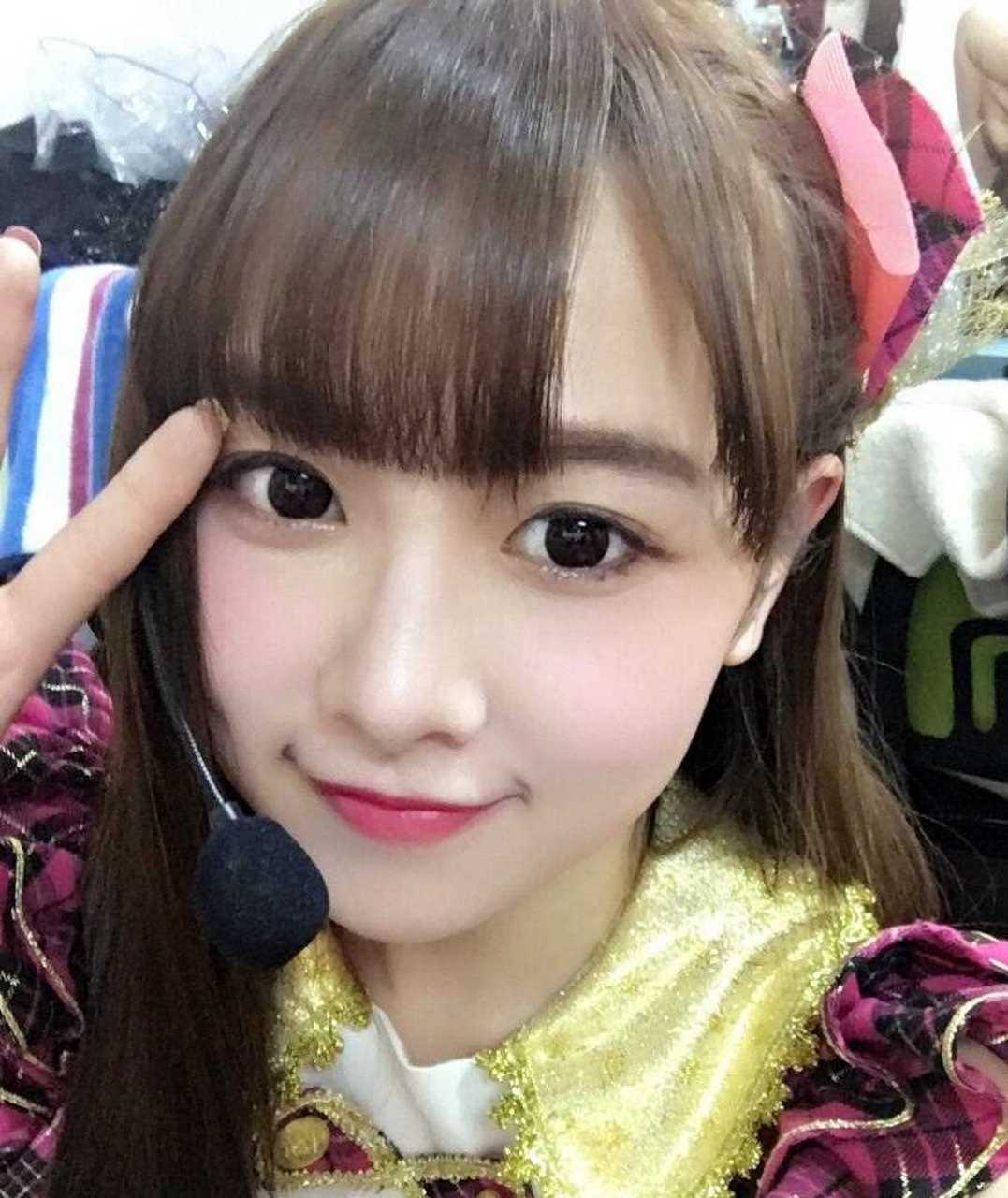 大家还记得全身80%被烧伤的snh48成员唐安琪吗?