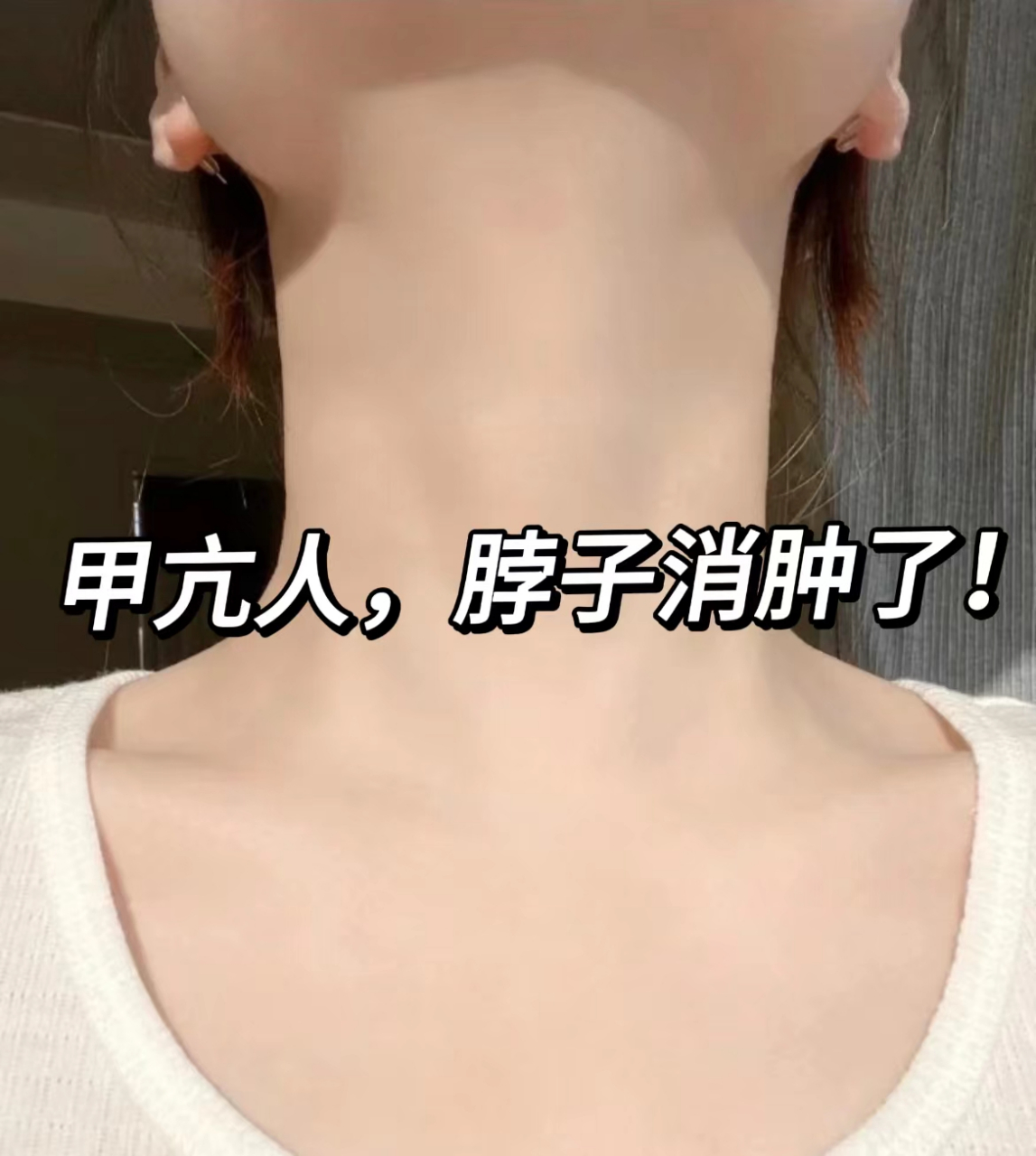 来诊时候,她说自己性子急容易发怒还怕热,爱出汗