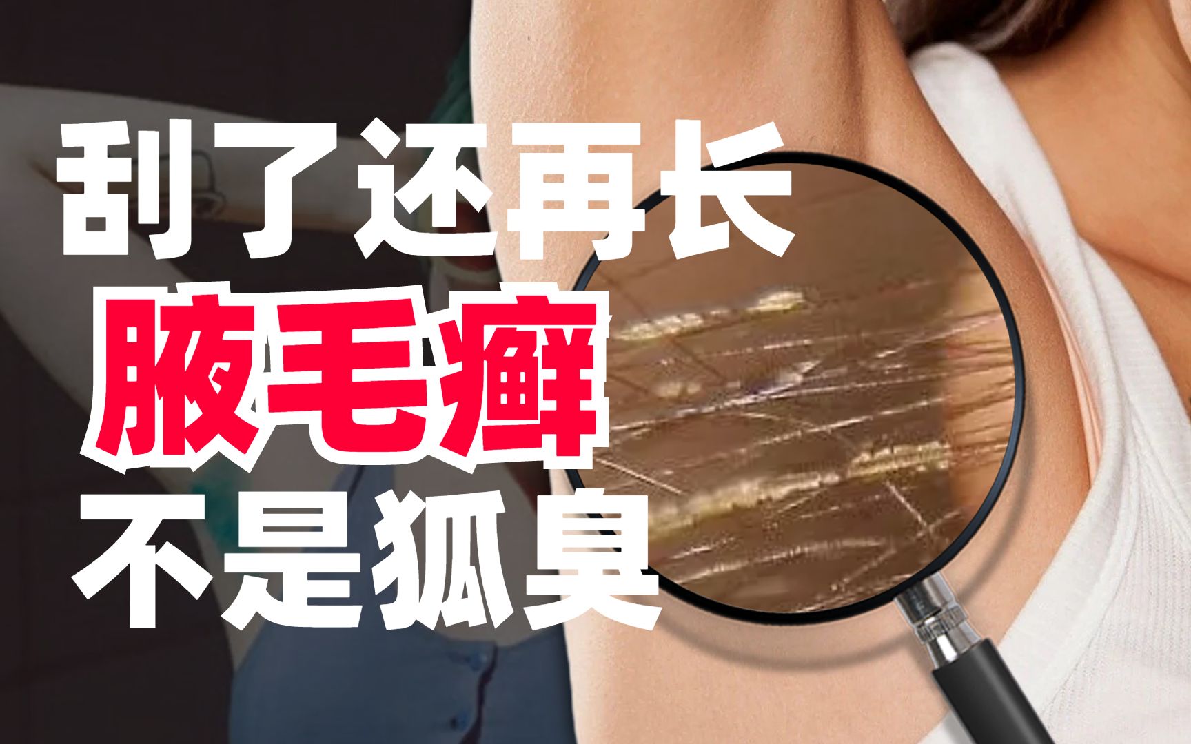 有些男性可能会发现,腋毛上出现了一些白白的,像蜡一样的物质,并伴随