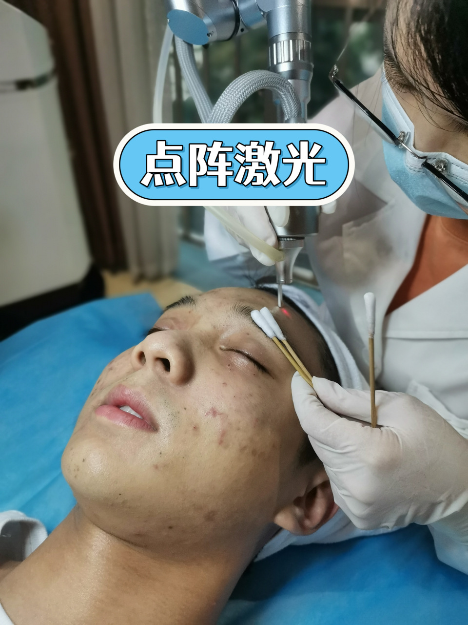 点阵激光祛痘坑没有瓶颈期吗?