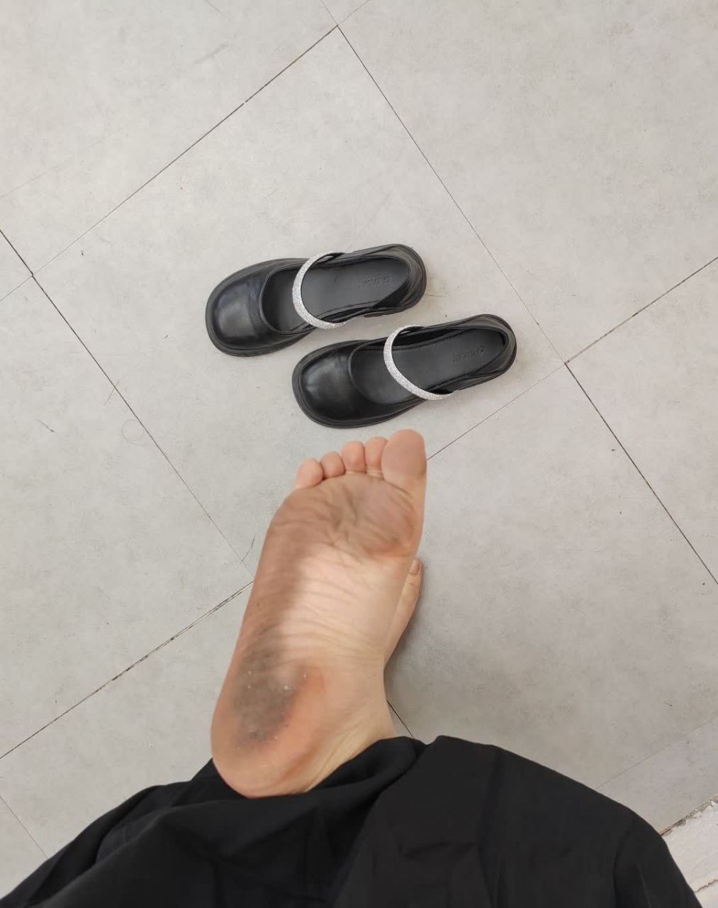 什么是褪色? 脚底板是黑色的[抠鼻]