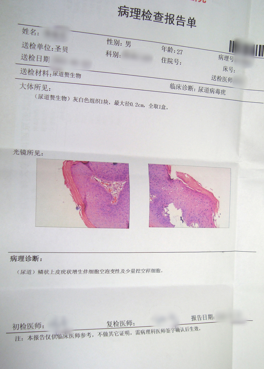 一个月前,他发现尿道口出现一个米粒大小的皮损,也不疼痛,也不瘙痒,用
