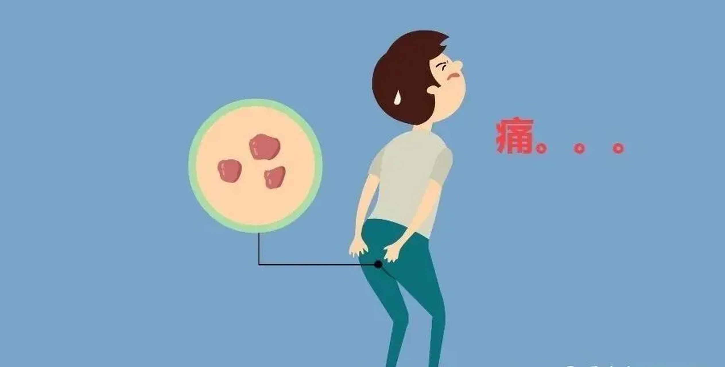 沈阳做痔疮手术最好的医院有哪些,选#沈阳中泰肛肠医院# 痔疮是一种