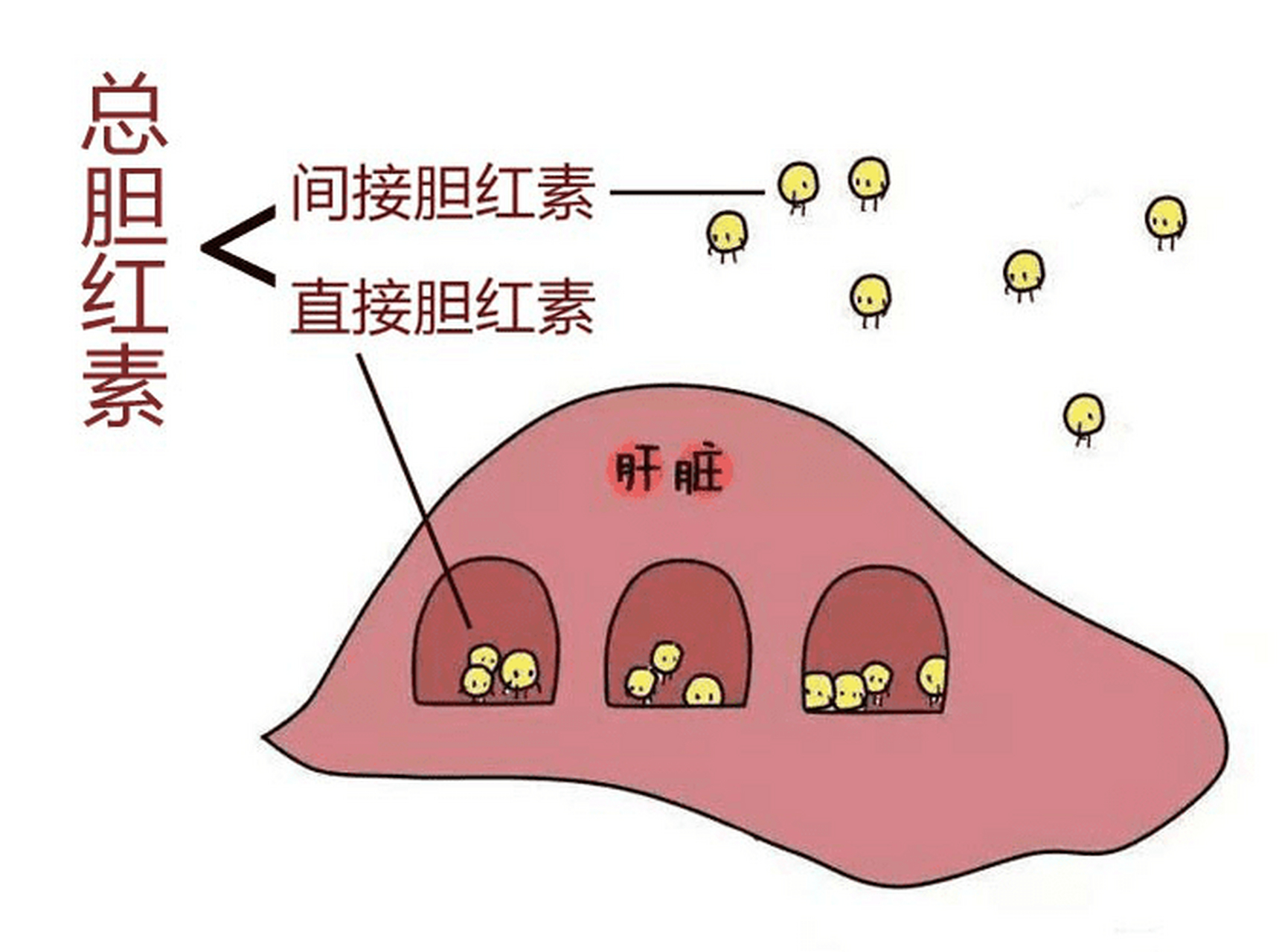 1,胆汁增高:胆红素高是胆汁淤积引起的,有胆汁酸的增高,患