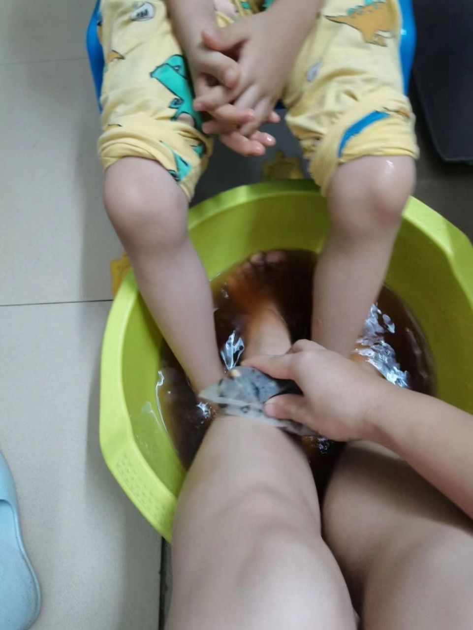 矮个娃脾虚不长个,老中医让陈皮泡脚一个月  如果孩子突然食欲变差