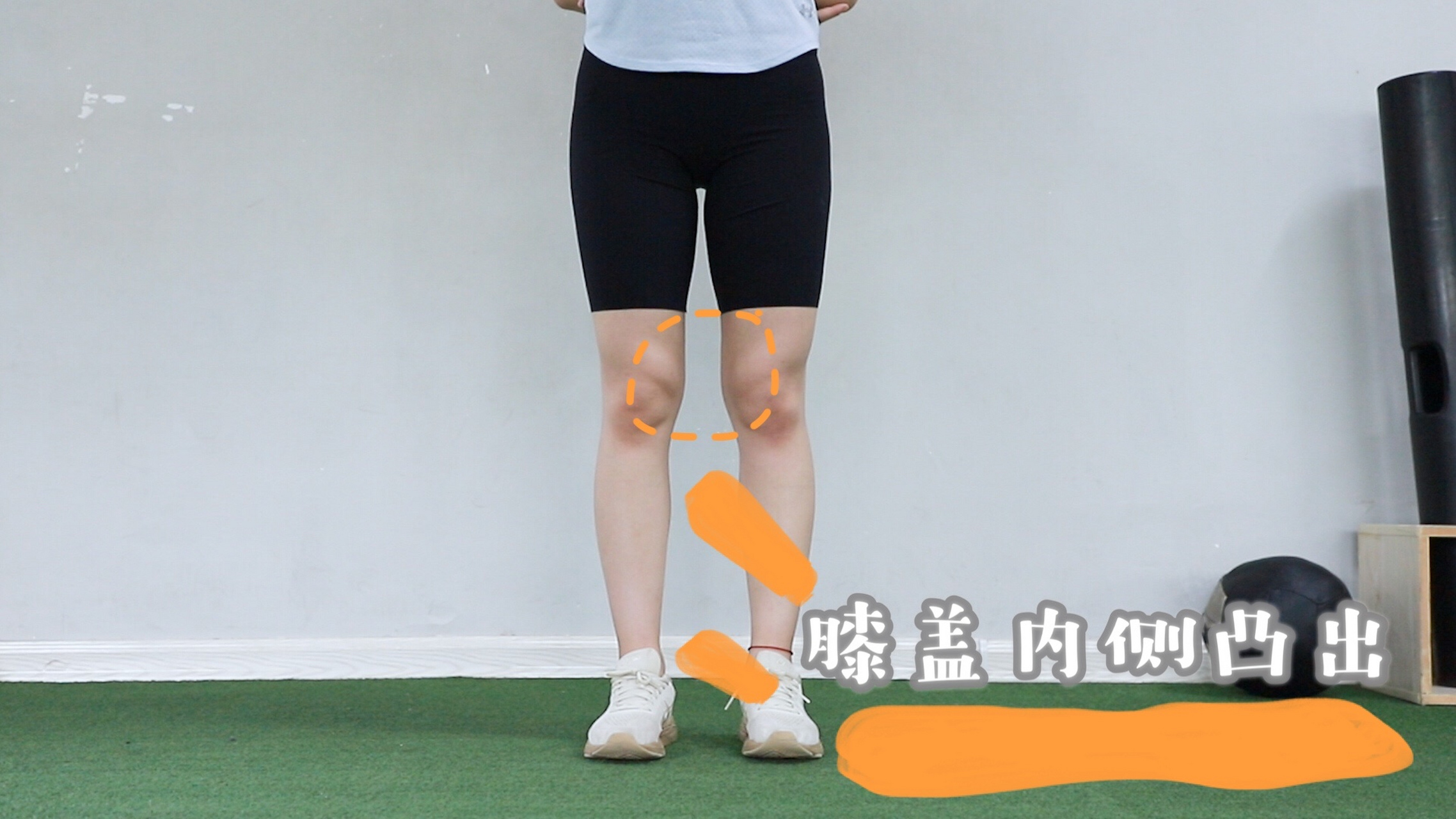 [思考]有很多人发现自己的膝盖内侧过于凸出,显得腿不直,摸起来肉肉