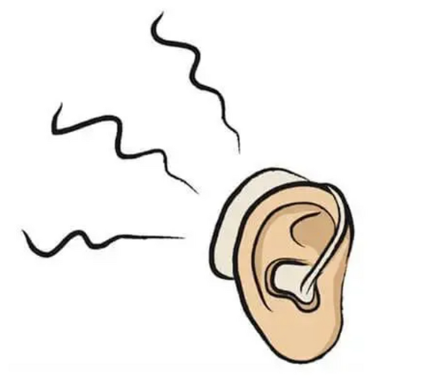 如何选配助听器# 交联式助听器是一种在耳道内放置的助听器,它通过一