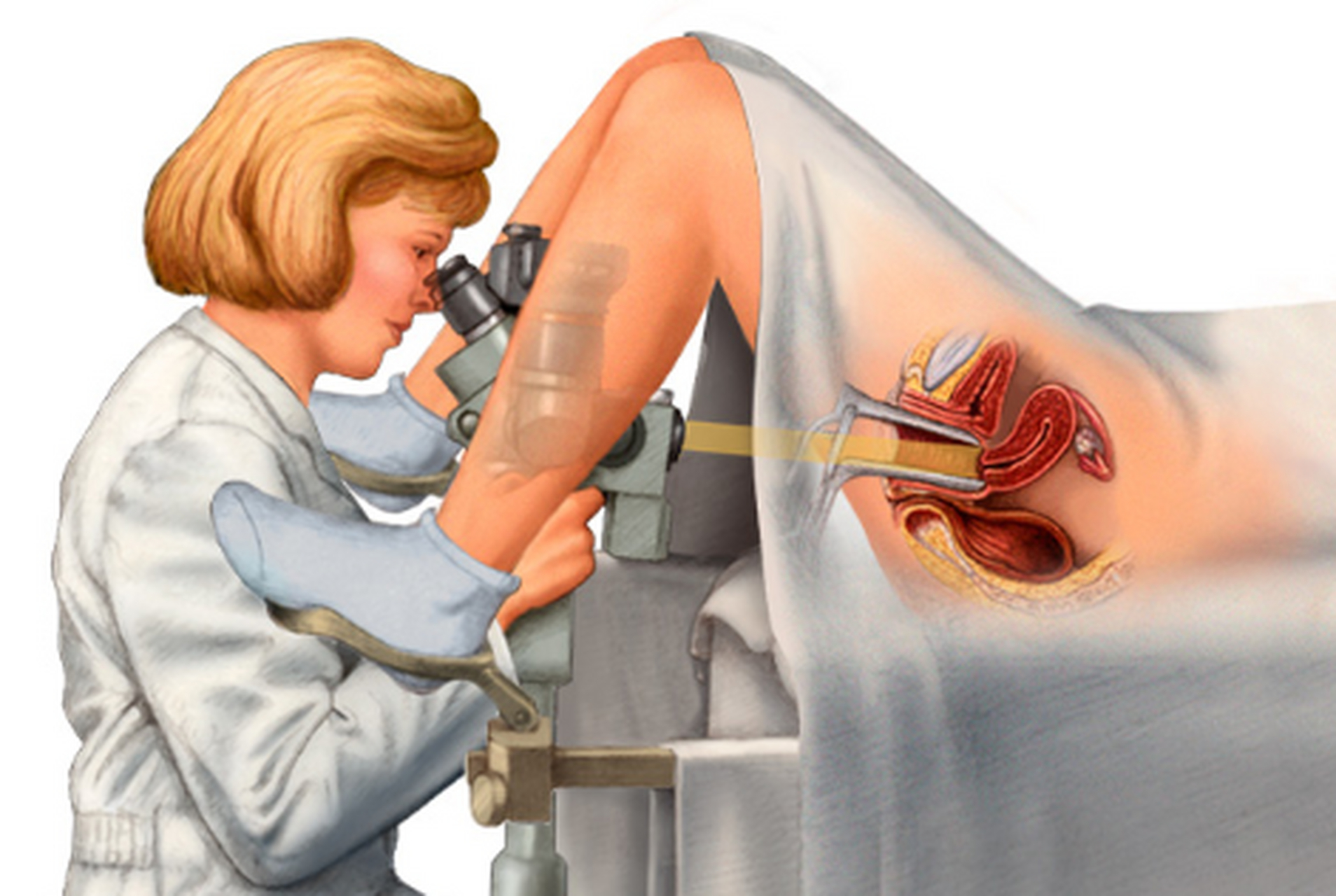 常规的妇科检查包括腹部检查,外阴阴道检查,双合诊