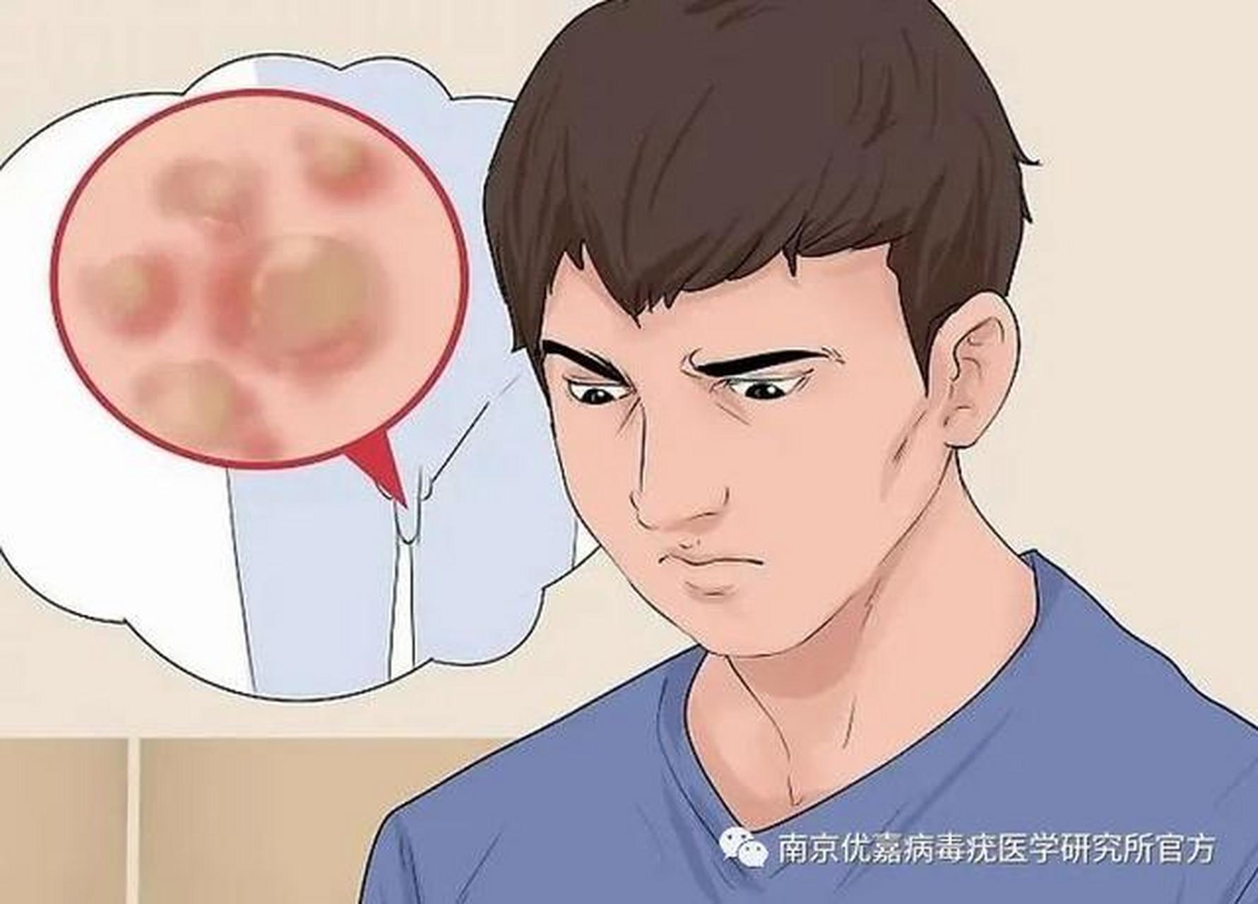 男性朋友在冠状沟的部位会长出一圈白白的,小小的疹子,叫珍珠疹.