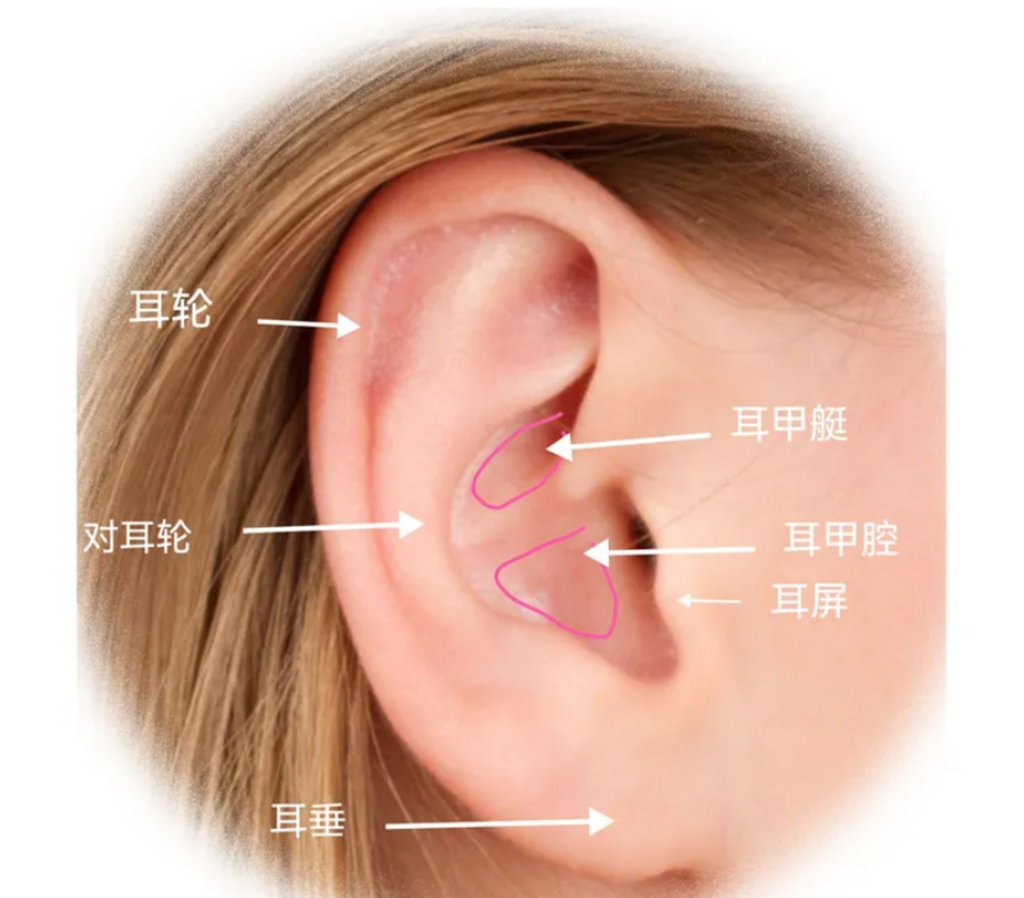 耳软骨比较容易获得,创伤小,耳软骨隆鼻外形自然,质地较柔和,比较接近