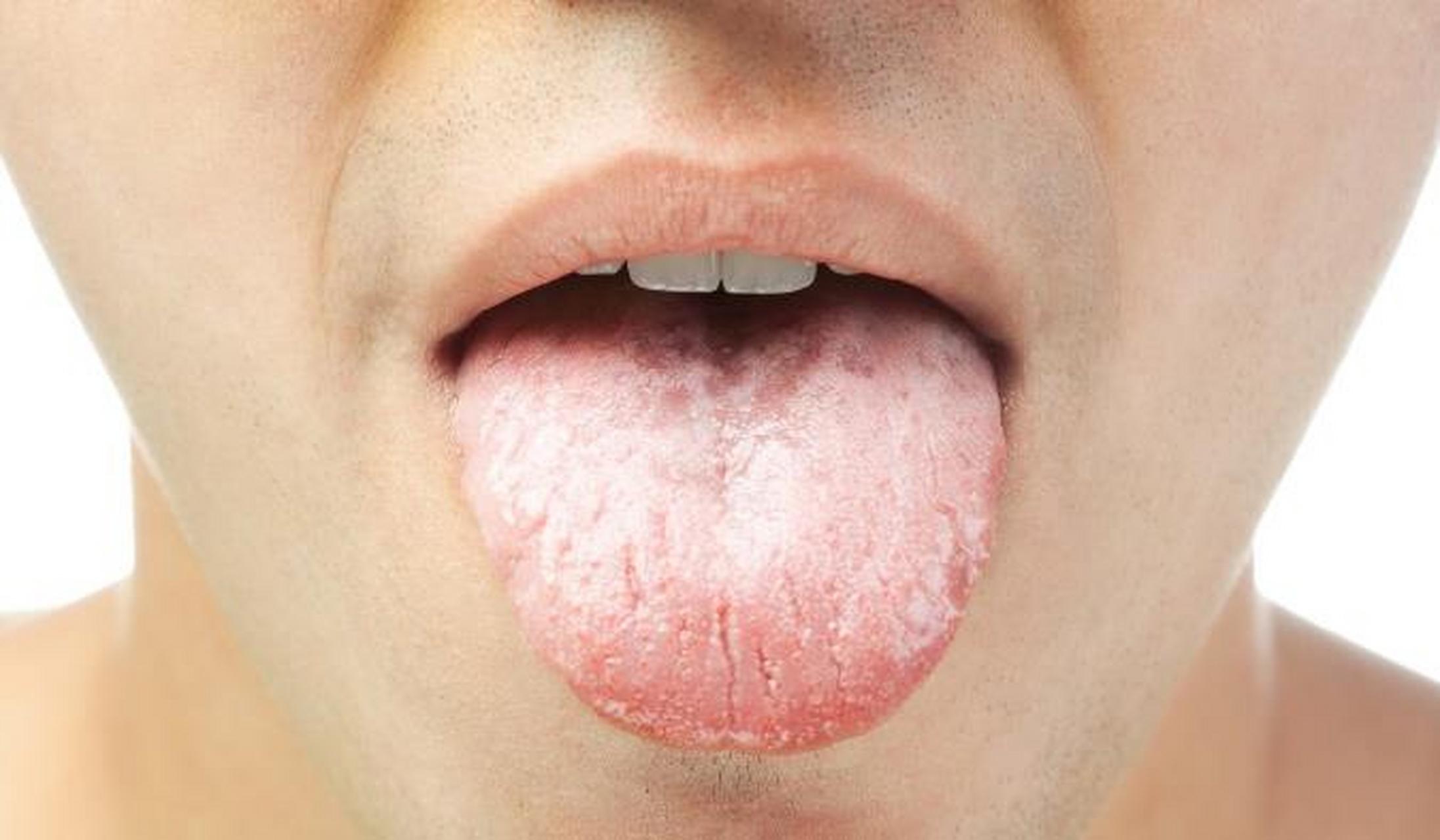 舌为心之苗:心脏不好,舌头或出现4个变化,不妨对照看一看