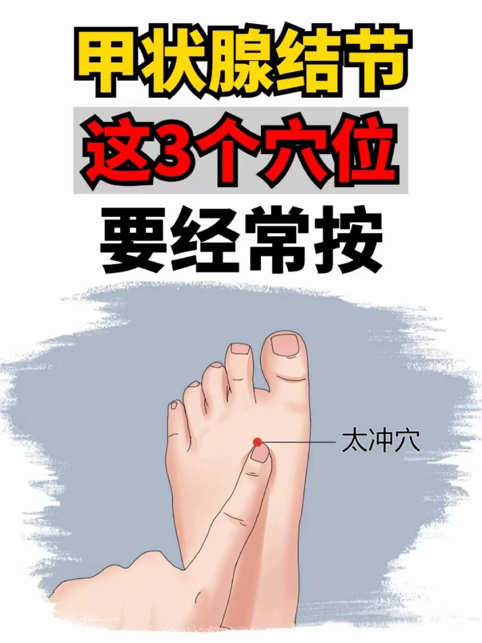 甲状腺结节按摩部位图图片