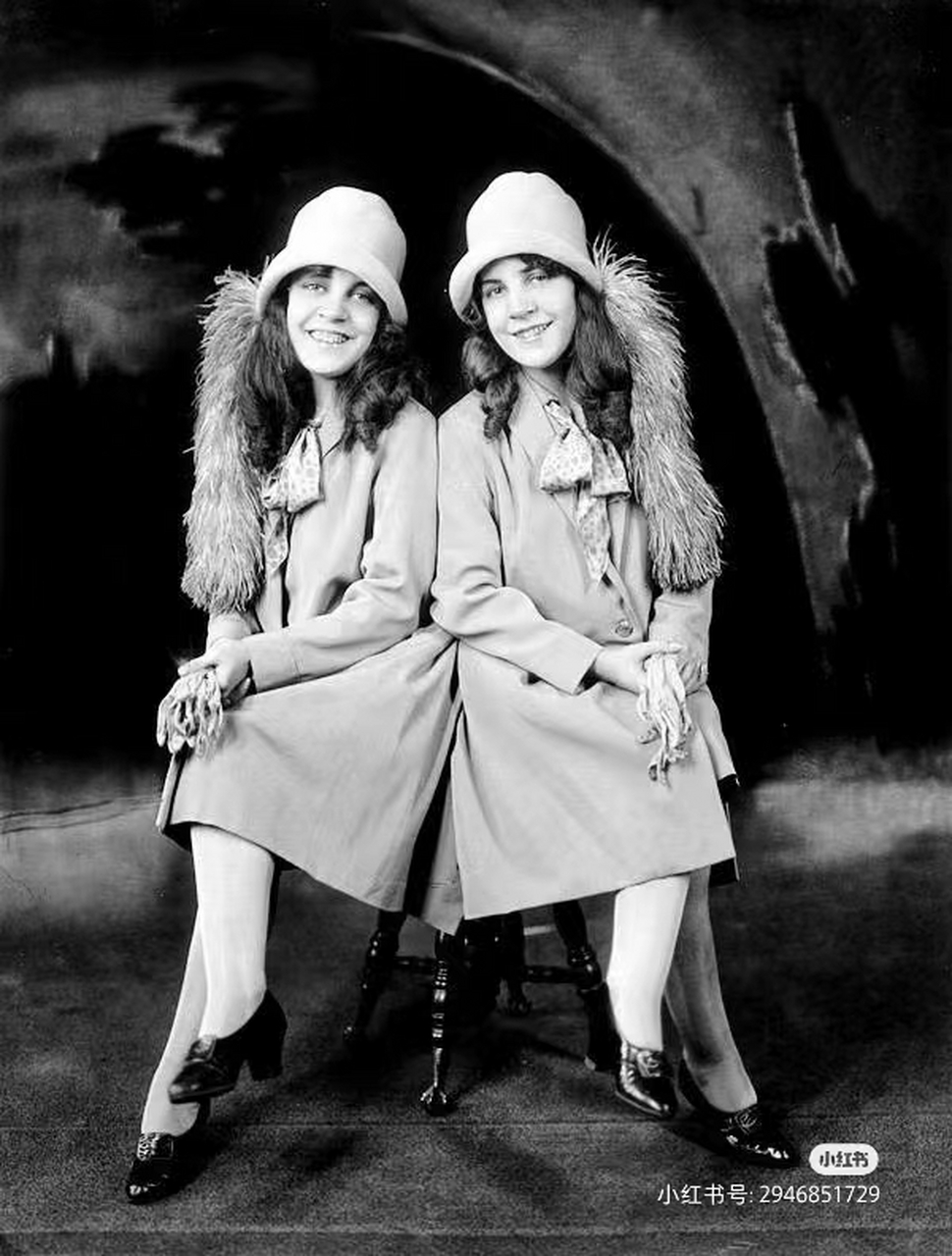 英国出生的连体双胞胎希尔顿姐妹,因为臀部连接在一起而被送给了玛丽