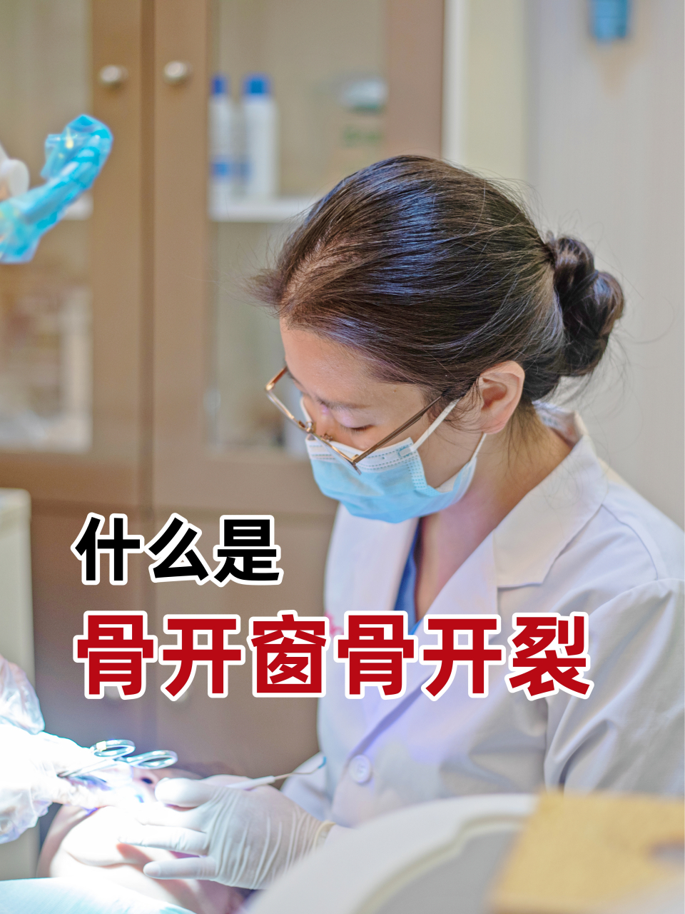 骨开窗:因为牙槽骨缺损,导致牙根没有得到完整覆盖,或者因为正畸施力