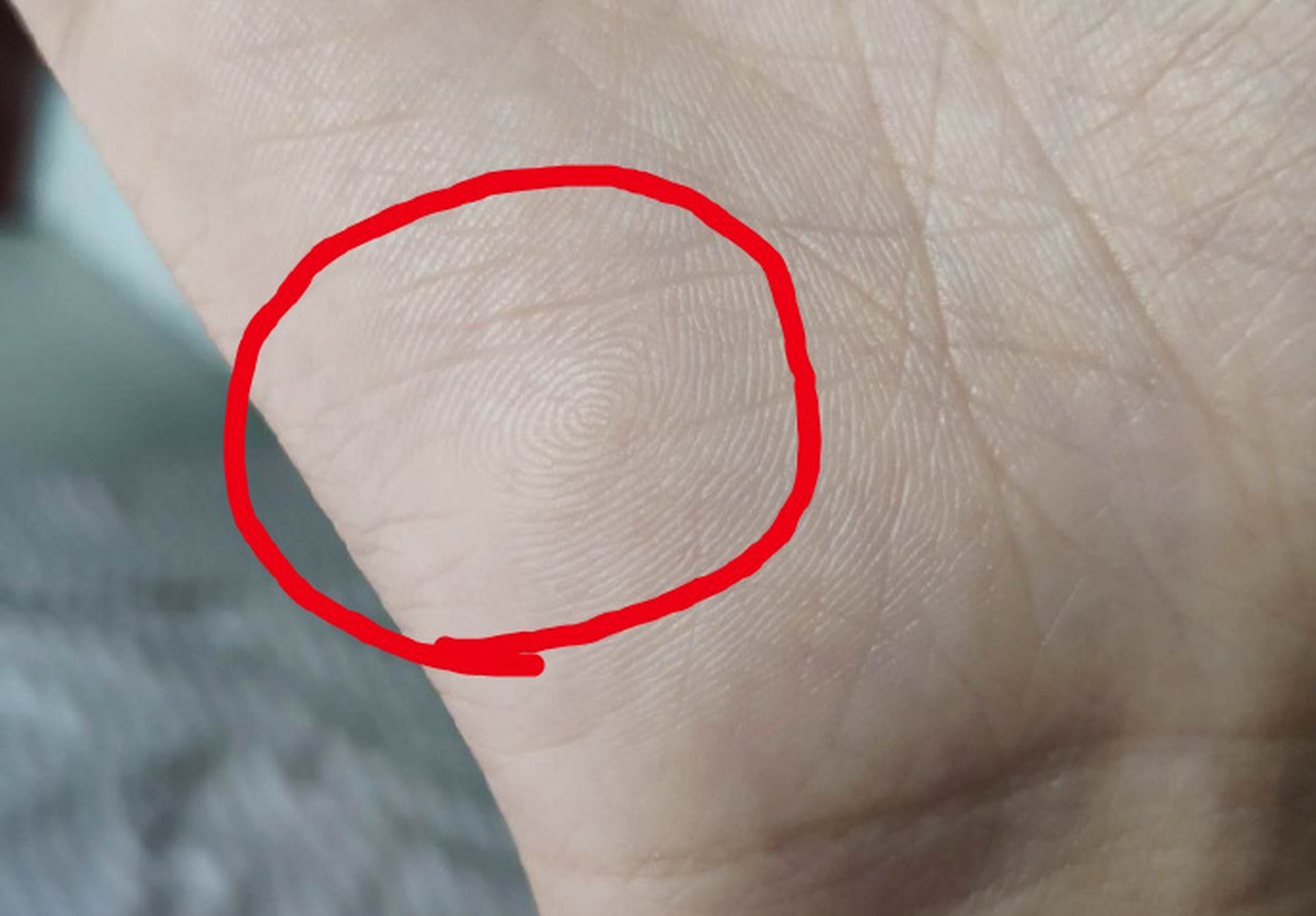 手相案例:  月丘有斗纹,也就是宝晕纹,这在古代宜拜将封侯的手相,无论