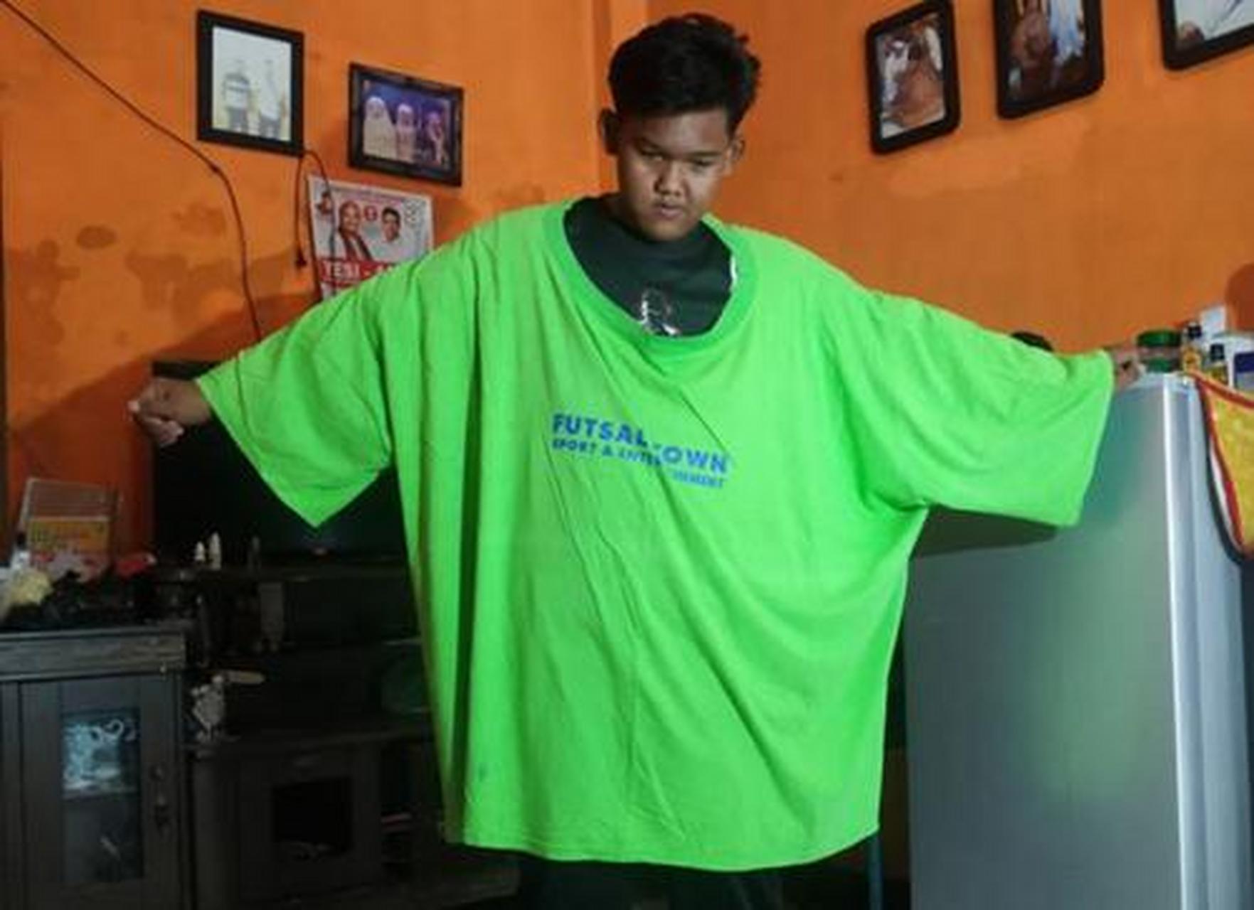 曾被称为世界最胖的印尼男孩日前成功减肥,恢复正常生活.