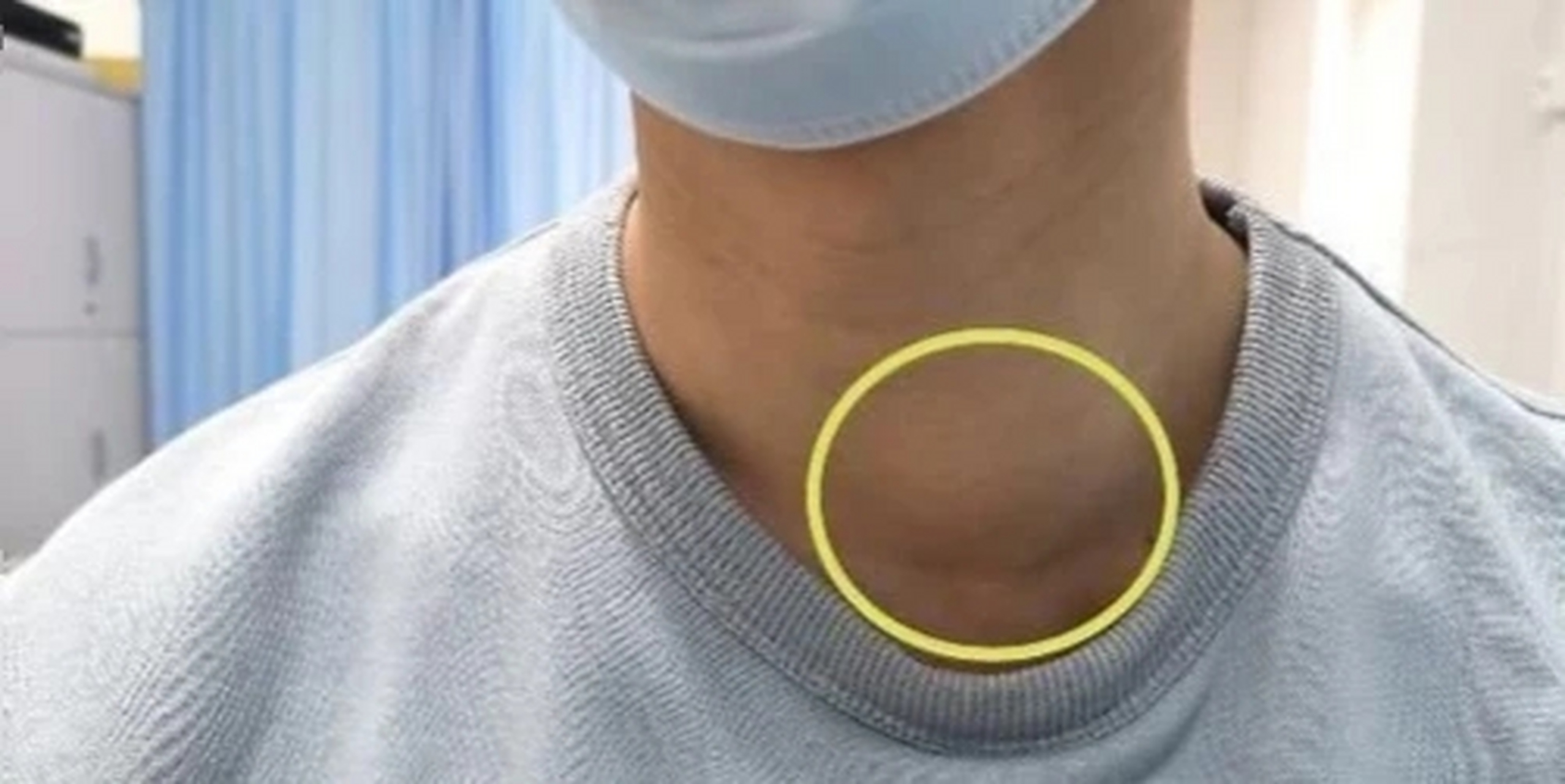 甲状腺瘤的主要原因有哪些?