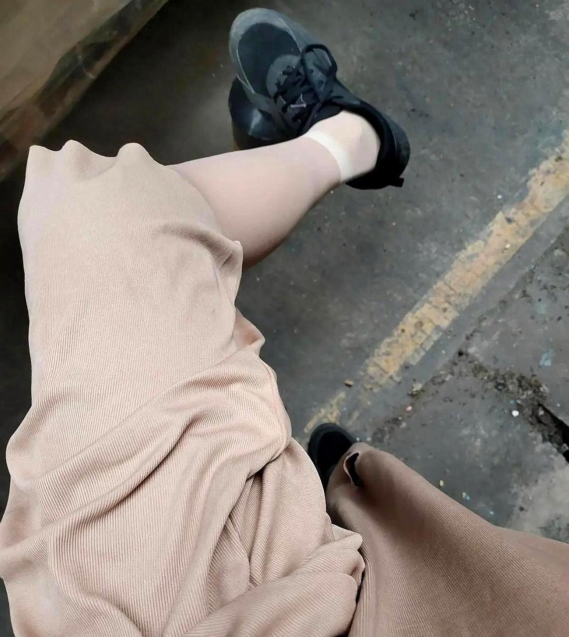 我这样的腿型是否正常?