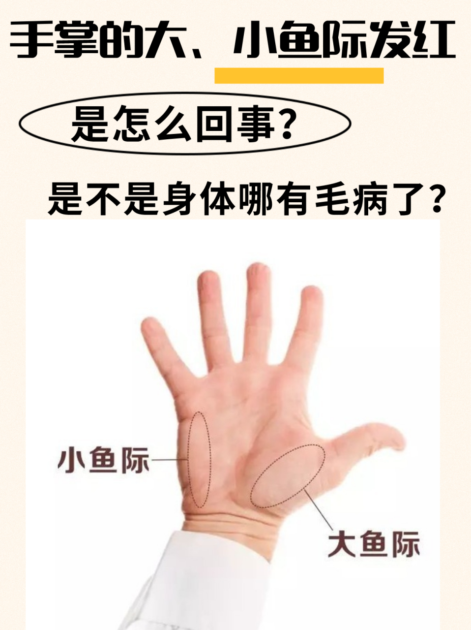 确实是,如果手掌的大,小鱼际处,特别红,很可能是"肝脏"出了问题.