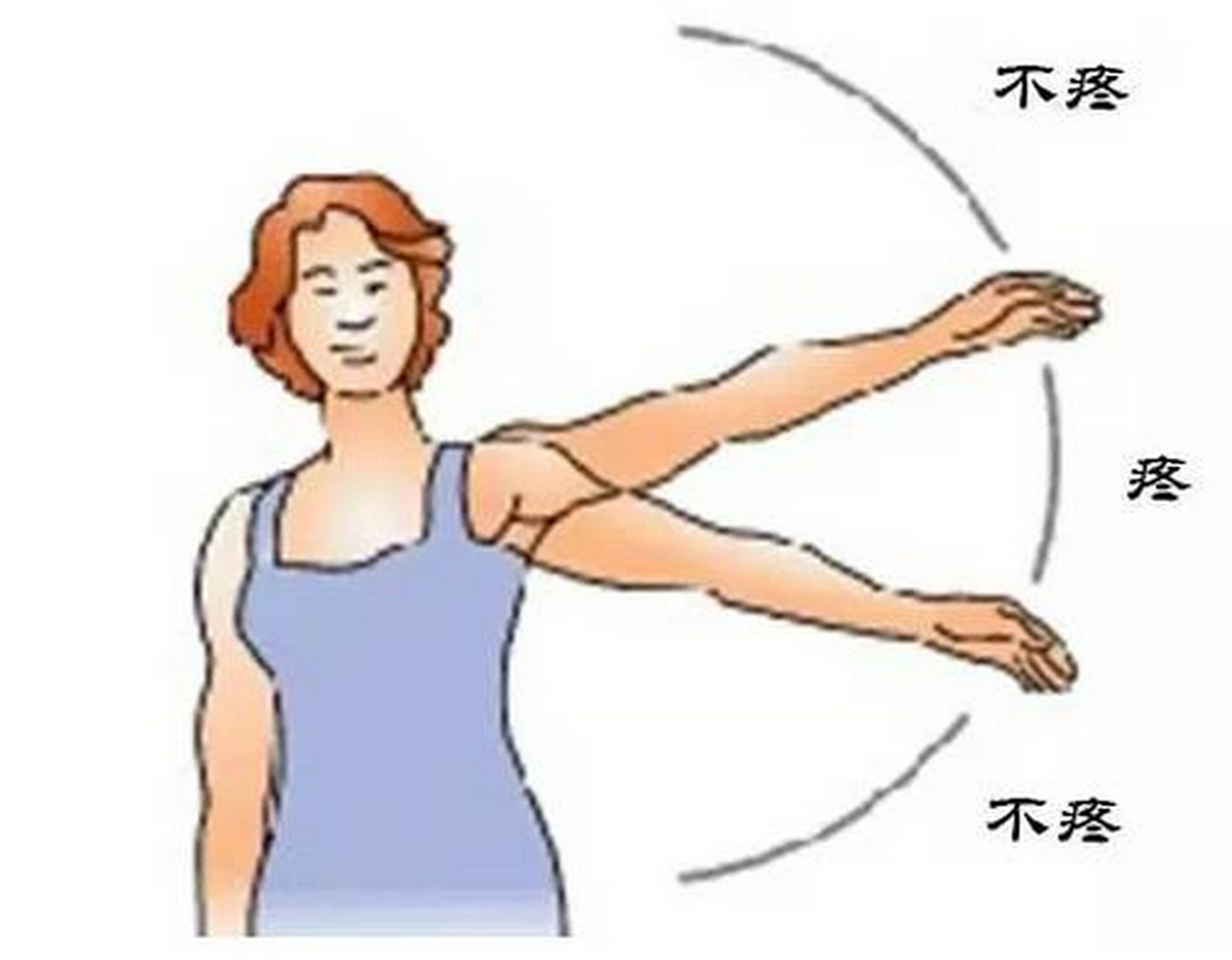 95教你如何判断肩周炎: 1,肩部疼痛 起初时肩部呈阵发性疼痛,多数为