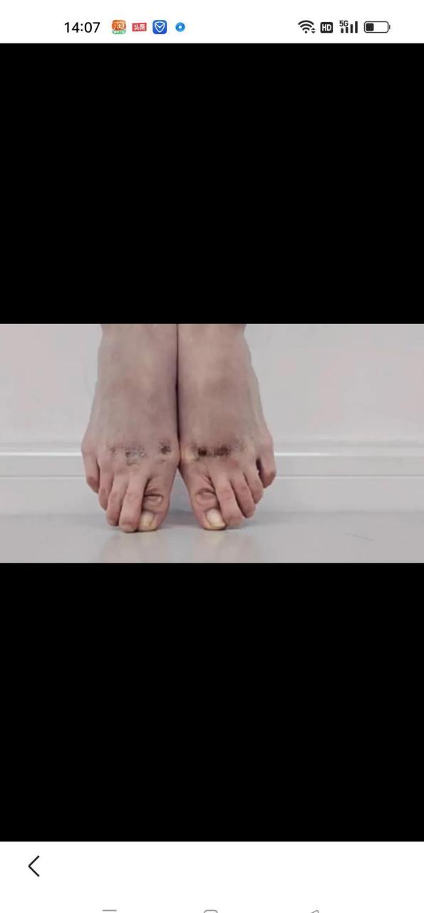 学芭蕾舞的脚,你们敢相信吗?艺术背后的辛酸[流泪]