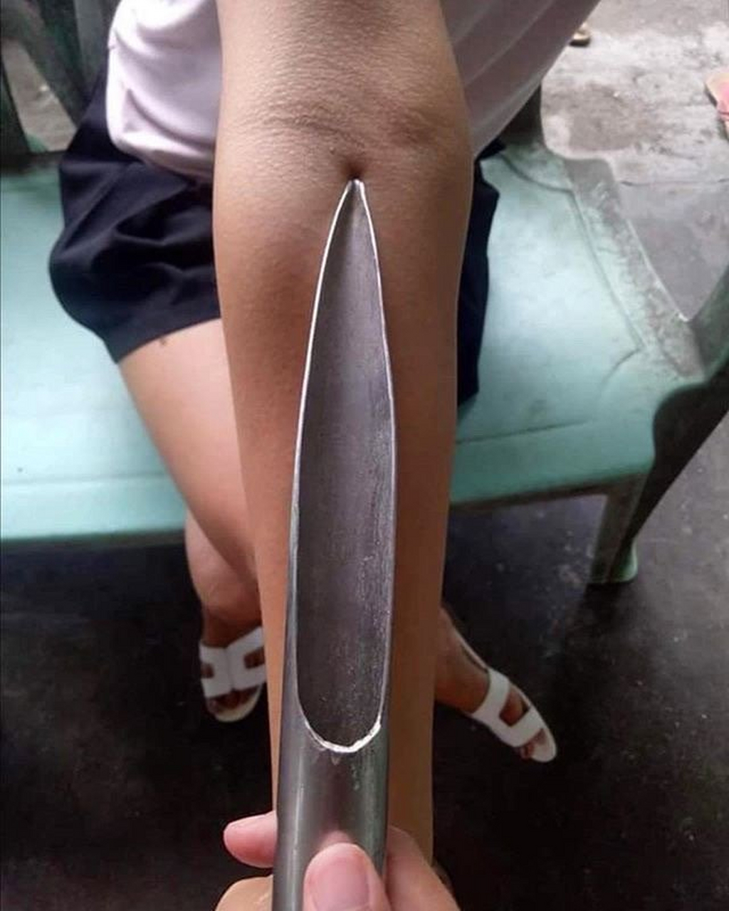 每次打针我眼中的抽血针头有多粗