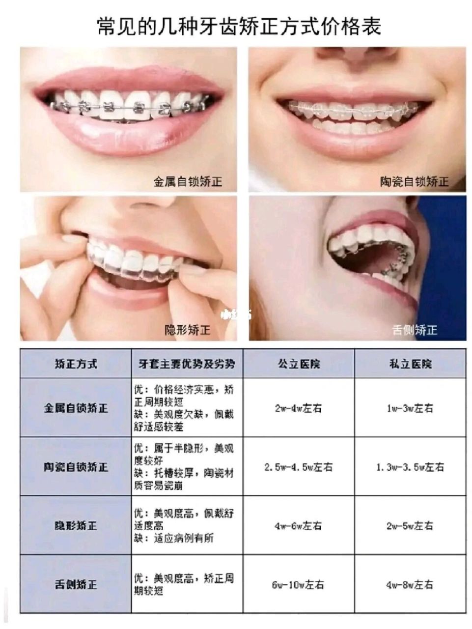牙套有几种 价格表图片