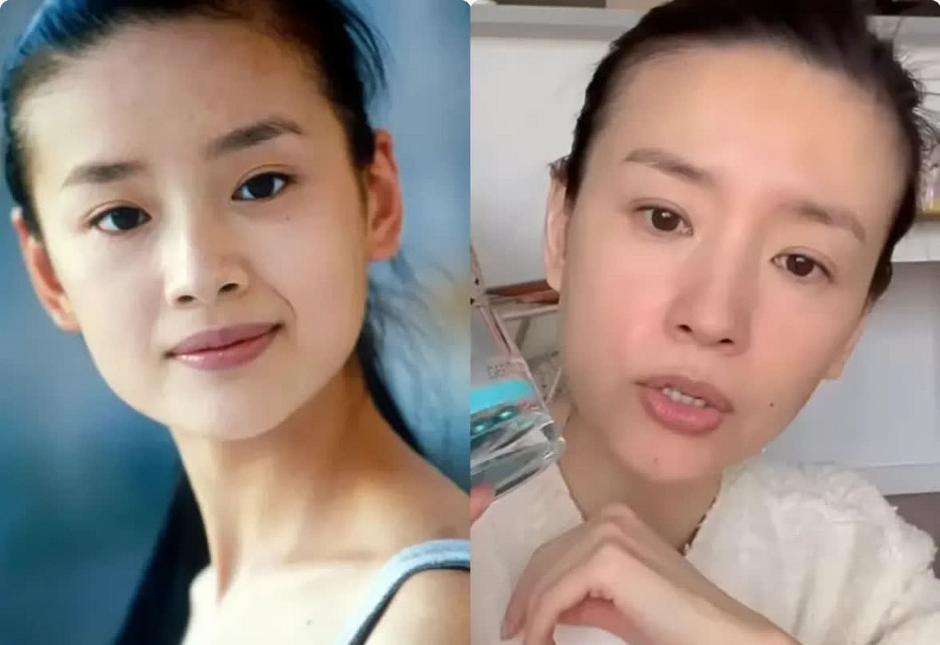 董洁年轻时的发际线相当高,但如今她已经43岁了,发际线一直保持不变