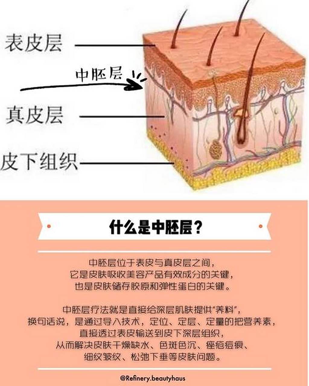 中胚层疗法是将营养物质以注射的方式注入到真皮层,从而解决问题的一