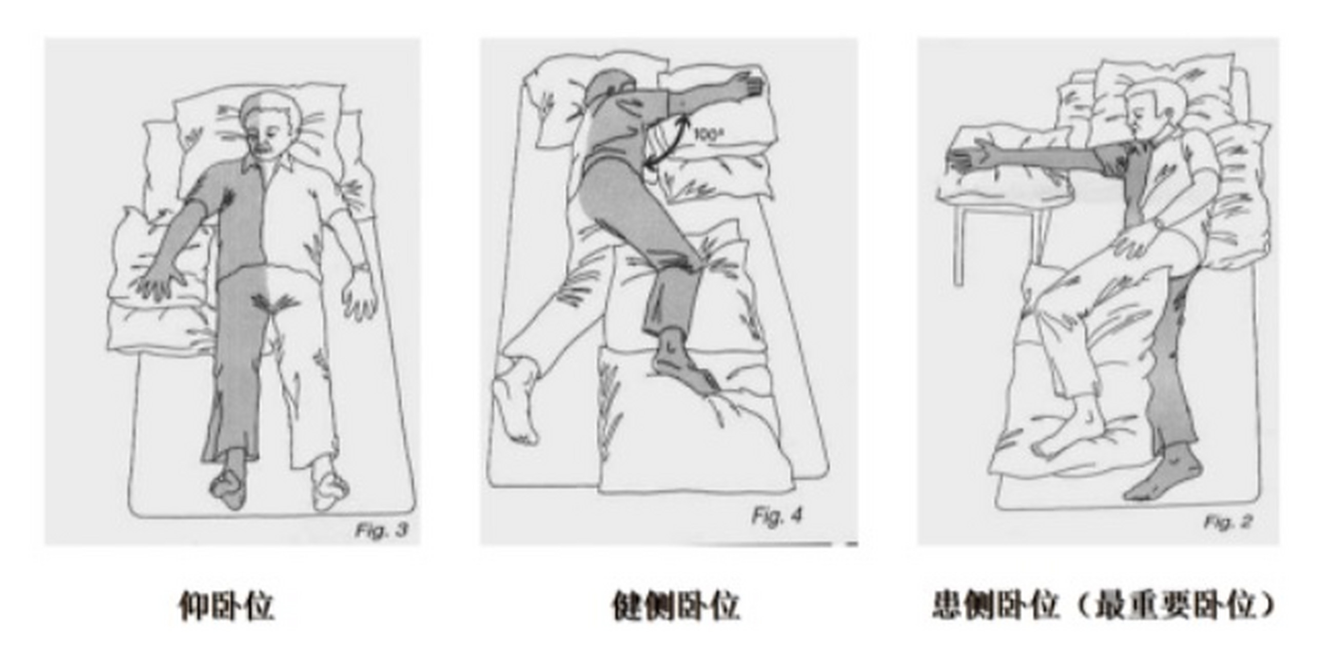 脑梗偏瘫患者的家庭护理#  卧床患者的良肢位摆放包括仰卧位,健侧卧