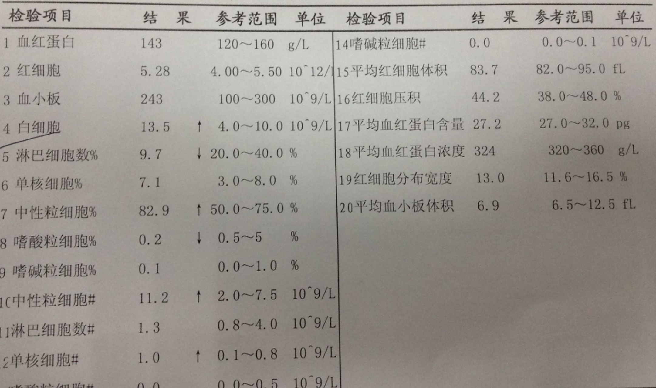 三甲专家教你如何看懂血常规报告 1,白细胞升高说明你有感染风险 2