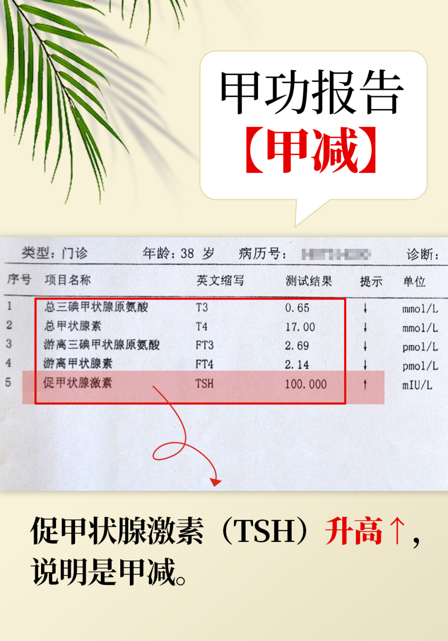 甲状腺功能五项,主要包括: 甲状腺素(t4) 三碘甲腺原氨酸(t3) 促枷儋